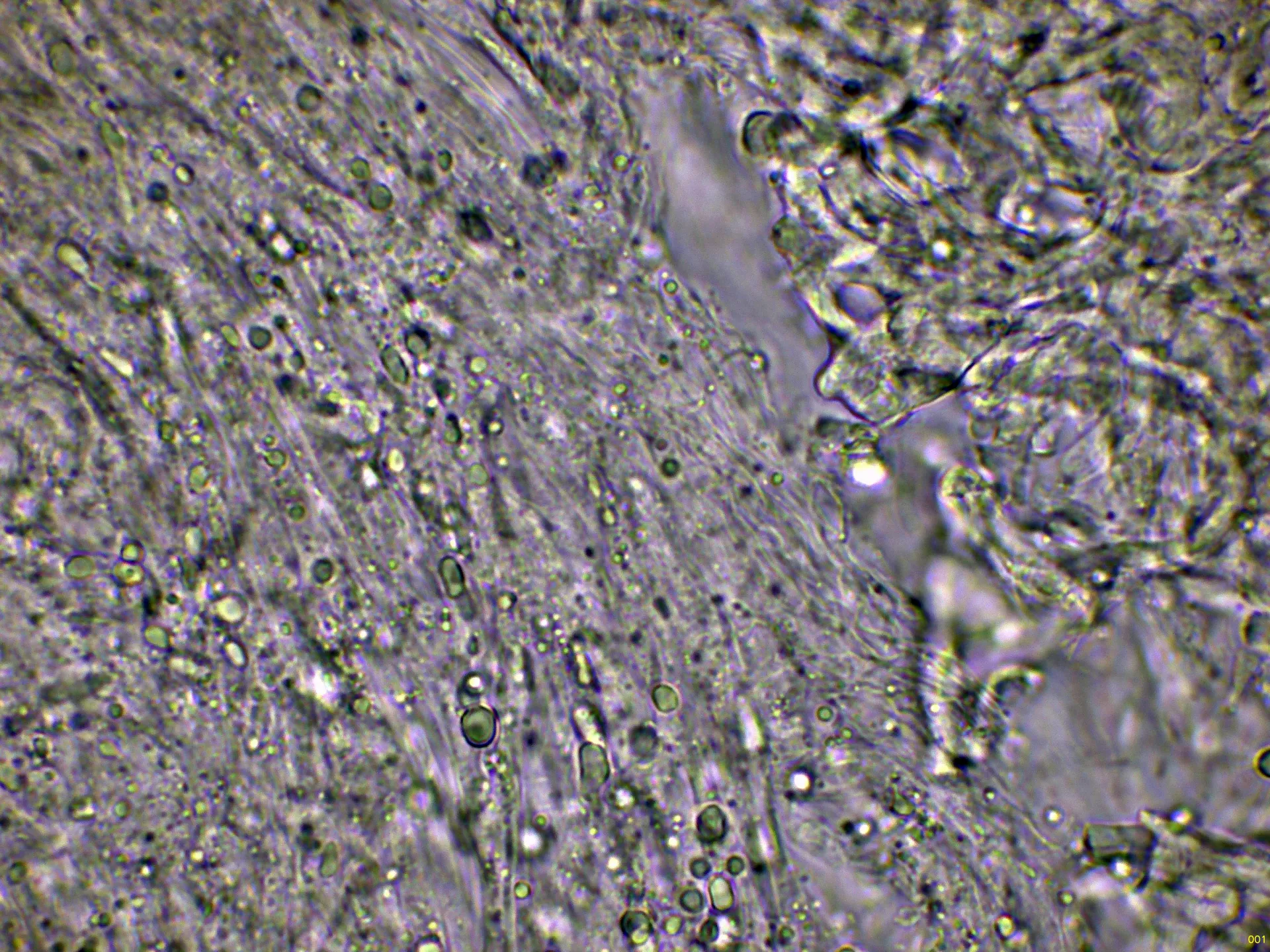 Microscopía de Sistotrema confluens - 10 - Hifas trama agua-001